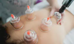 Featured image of post Cupping Therapy for Runners: Does It Really Work?